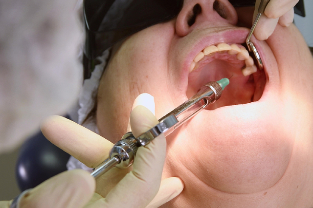 Tooth Implant Price, Tooth Implant Price Singapore